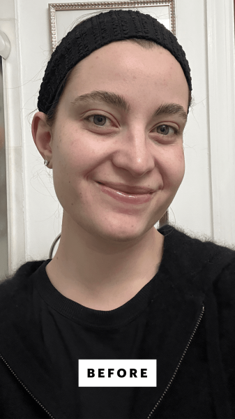 Felbin before applying the Knours PDRN Rice Green Tea Revitalizing Serum